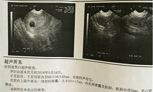 电脑系统b超怎么用_做系统b超怎么好通过